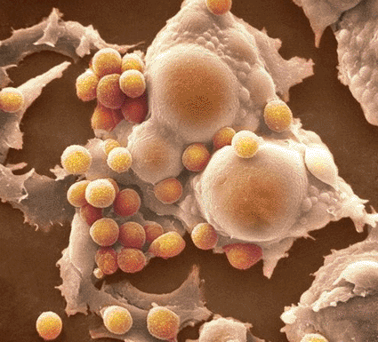 Image: Colored scanning electron micrograph (SEM) of adipocytes surrounded by granulocytes (Photo courtesy of SPL).